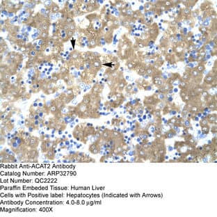 anti-Acetyl-CoA Acetyltransferase 2 (ACAT2) (Middle Region) antibody avatar