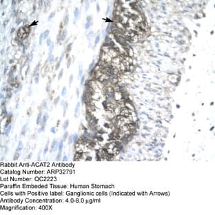 anti-Acetyl-CoA Acetyltransferase 2 (ACAT2) (Middle Region) antibody avatar