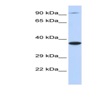 anti-Bardet-Biedl Syndrome 5 (BBS5) (Middle Region) antibody