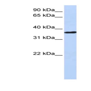 anti-Cysteine and Histidine-Rich Domain (CHORD)-Containing 1 (CHORDC1) (Middle Region) antibody avatar