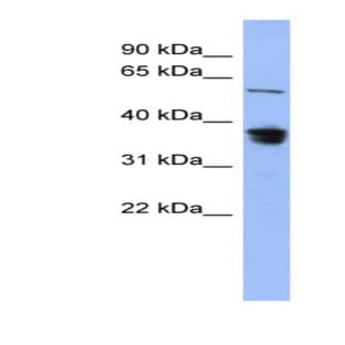 anti-RAD23 Homolog B (S. Cerevisiae) (RAD23B) (Middle Region) antibody avatar