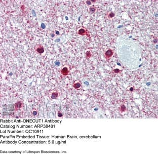 anti-One Cut Homeobox 1 (ONECUT1) (Middle Region) antibody avatar
