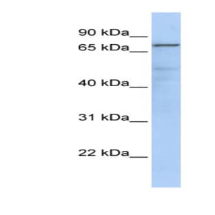 anti-Guanine Monphosphate Synthetase (GMPS) (Middle Region) antibody avatar