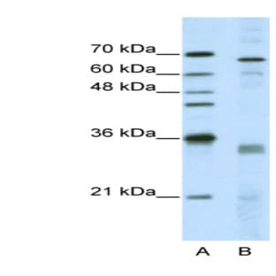 anti-serine/arginine-Rich Splicing Factor 1 (SRSF1) (Middle Region) antibody avatar