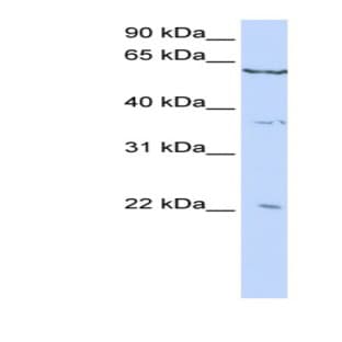 anti-Cysteine and Glycine-Rich Protein 2 (CSRP2) (C-Term) antibody avatar