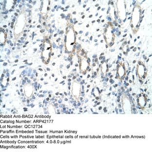 anti-BCL2-Associated Athanogene 2 (BAG2) (C-Term) antibody avatar