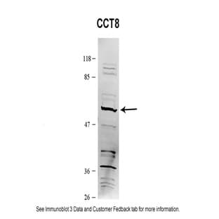 anti-Chaperonin Containing TCP1, Subunit 8 (Theta) (CCT8) (C-Term) antibody avatar