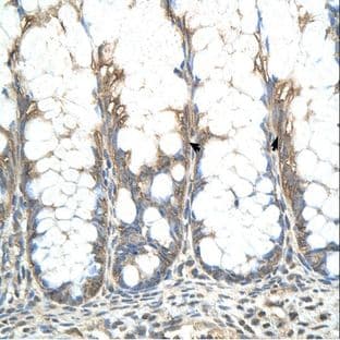 anti-Cysteine-Rich Hydrophobic Domain 2 (CHIC2) (N-Term) antibody avatar