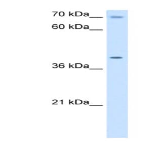 anti-Cytochrome C Oxidase Assembly Homolog 15 (Yeast) (COX15) (N-Term) antibody avatar