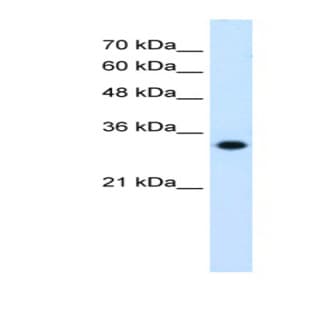 anti-3-Hydroxymethyl-3-Methylglutaryl-CoA Lyase (HMGCL) (C-Term) antibody avatar