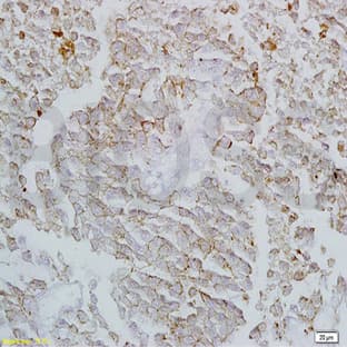 anti-Claudin 4 (CLDN4) antibody avatar