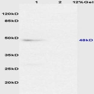 anti-Caspase 8, Apoptosis-Related Cysteine Peptidase (CASP8) antibody avatar