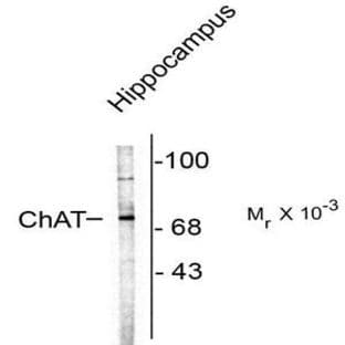 anti-Choline O-Acetyltransferase (CHAT) antibody avatar