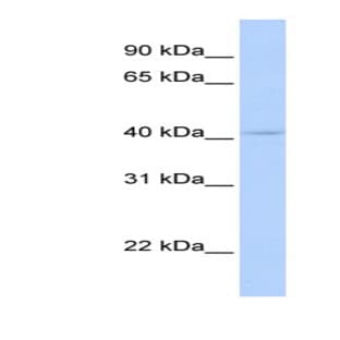 anti-D4, Zinc and Double PHD Fingers, Family 3 (DPF3) (Middle Region) antibody avatar