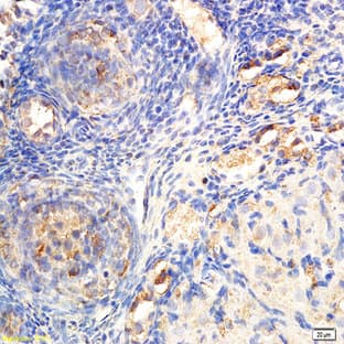 anti-DEAD Box Protein 4 (DDX4) antibody avatar
