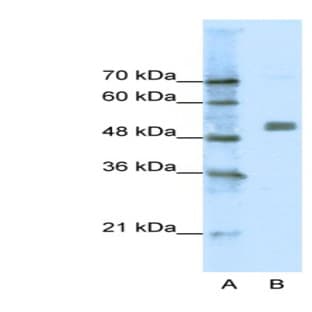 anti-Cholinergic Receptor, Nicotinic, alpha 9 (Neuronal) (CHRNA9) (N-Term) antibody avatar