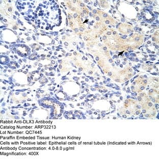 anti-Distal-Less Homeobox 3 (DLX3) (N-Term) antibody