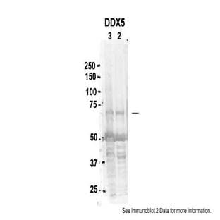 anti-DEAD (Asp-Glu-Ala-Asp) Box Polypeptide 5 (DDX5) (C-Term) antibody avatar