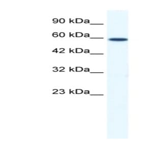 anti-DEAD (Asp-Glu-Ala-Asp) Box Polypeptide 5 (DDX5) (N-Term) antibody avatar