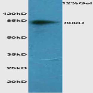 anti-CD44 (CD44) antibody avatar