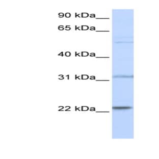 anti-Cell Division Cycle 42 (GTP Binding Protein, 25kDa) (CDC42) (N-Term) antibody avatar