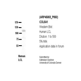 anti-Collagen, Type VI, alpha 1 (COL6A1) (Middle Region) antibody avatar
