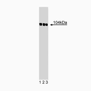 anti-Actinin, alpha (ACTN) (AA 629-825) antibody avatar