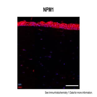 anti-Nucleophosmin (Nucleolar phosphoprotein B23, Numatrin) (NPM1) (Middle Region) antibody avatar