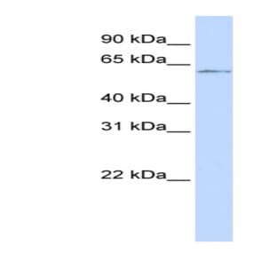 anti-Nuclear Factor I/C (CCAAT-Binding Transcription Factor) (NFIC) (Middle Region) antibody avatar