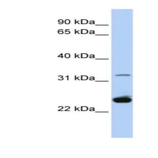 anti-Proteolipid Protein 1 (PLP1) (Middle Region) antibody avatar
