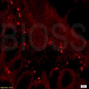 anti-CD28 (CD28) antibody avatar