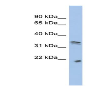 anti-Cyclin-Dependent Kinase 1 (CDK1) (Middle Region) antibody avatar