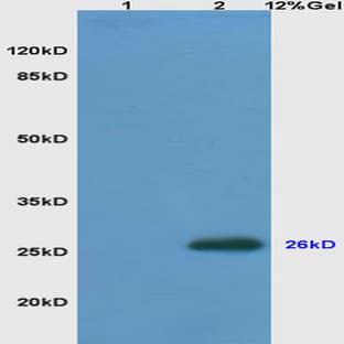 anti-B-Cell CLL/lymphoma 2 (BCL2) antibody