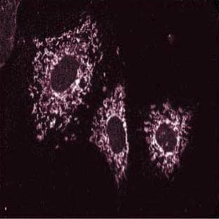 anti-Cortactin (CTTN) antibody avatar