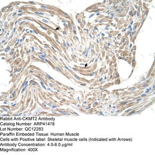 anti-Creatine Kinase, Mitochondrial 2 (Sarcomeric) (CKMT2) (N-Term) antibody avatar