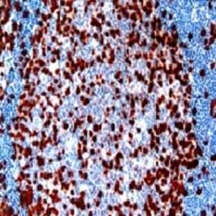 anti-CD3 (CD3) antibody avatar