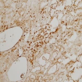 anti-CD3 (CD3) (Chain delta) antibody avatar