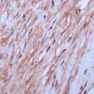 anti-Actin, beta (ACTB) (N-Term) antibody avatar