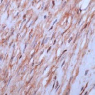 anti-Actin, beta (ACTB) (N-Term) antibody avatar