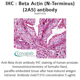 anti-Actin, beta (ACTB) antibody avatar