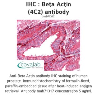anti-Actin, beta (ACTB) (N-Term) antibody avatar