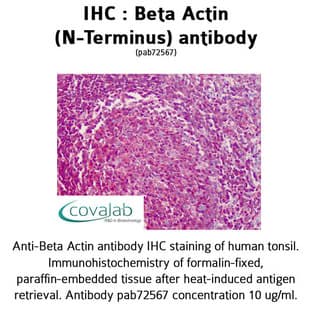 anti-Actin, beta (ACTB) (N-Term) antibody avatar