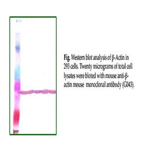 anti-Actin, beta (ACTB) antibody avatar