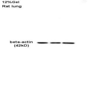 anti-Actin, beta (ACTB) antibody avatar