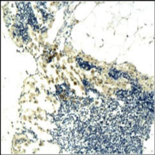 anti-CD3 (CD3) (Middle Region) antibody avatar