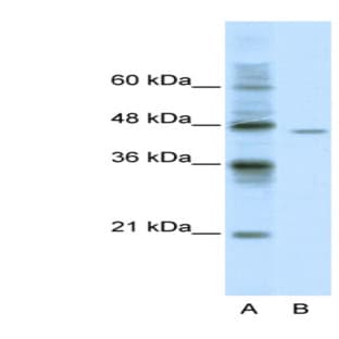 anti-DEAD (Asp-Glu-Ala-Asp) Box Polypeptide 25 (DDX25) (C-Term) antibody avatar