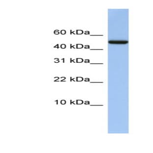 anti-4-Aminobutyrate Aminotransferase (ABAT) (Middle Region) antibody avatar