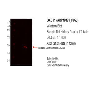 anti-3-Oxoacid CoA Transferase 1 (OXCT1) (Middle Region) antibody avatar