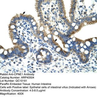 anti-Copine I (CPNE1) (N-Term) antibody avatar
