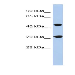 anti-Chromosome 22 Open Reading Frame 25 (C22orf25) (N-Term) antibody avatar
